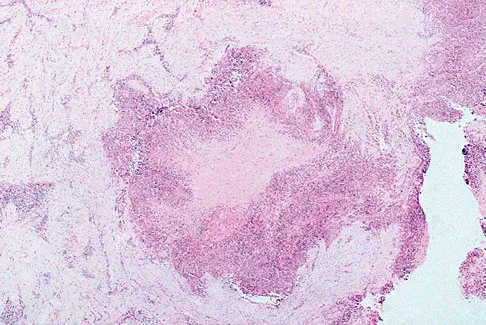 Orthopedic Surgery Board Review 2026 | High-Yield MCQs - Set 4 - Figure 60