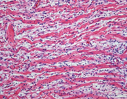 Orthopedic Surgery Board Review 2026 | High-Yield MCQs - Set 4 - Figure 68