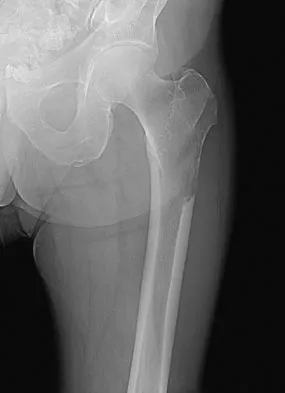 Orthopedic Surgery Board Review 2026 | High-Yield MCQs - Set 4 - Figure 72