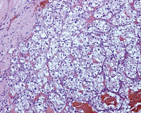 Orthopedic Surgery Board Review 2026 | High-Yield MCQs - Set 4 - Figure 75