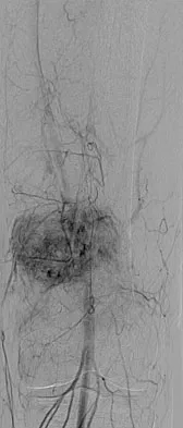 Orthopedic Surgery Board Review 2026 | High-Yield MCQs - Set 4 - Figure 81
