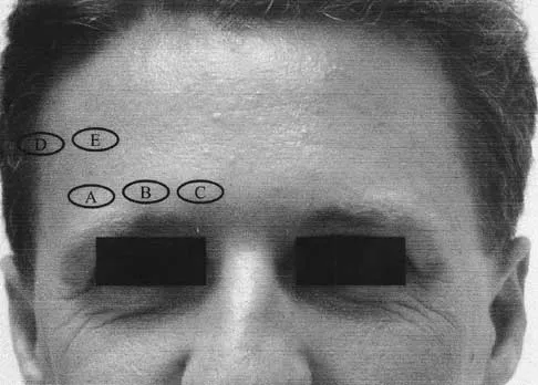 Orthopedic Surgery Board Review 2026 | High-Yield MCQs - Set 4 - Figure 86