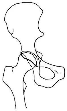 Orthopedic Surgery Board Review 2026 | High-Yield MCQs - Set 4 - Figure 88