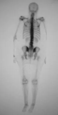 Orthopedic Surgery Board Review 2026 | High-Yield MCQs - Set 4 - Figure 96