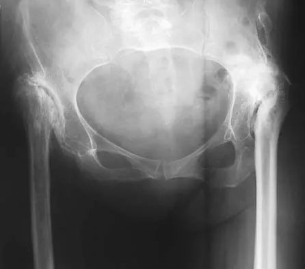 Orthopedic Surgery Board Review 2026 | High-Yield MCQs - Set 5 - Figure 15