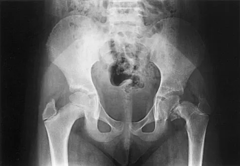 Orthopedic Surgery Board Review 2026 | High-Yield MCQs - Set 5 - Figure 2