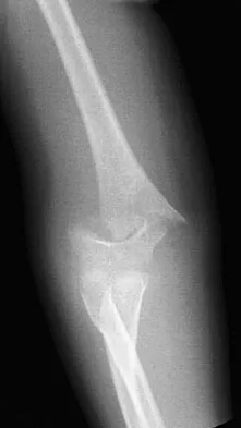 Orthopedic Board Review MCQs (2026 Edition) - Part 6