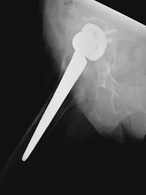 Orthopedic Surgery Board Review 2026 | High-Yield MCQs - Set 5 - Figure 27