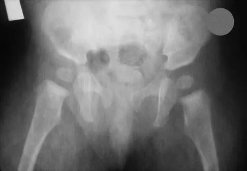 Orthopedic Surgery Board Review 2026 | High-Yield MCQs - Set 5 - Figure 33