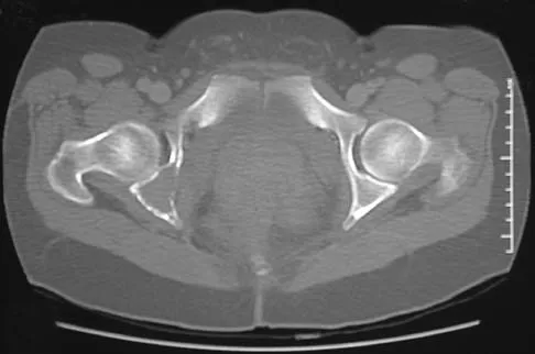 Orthopedic Surgery Board Review 2026 | High-Yield MCQs - Set 5 - Figure 38