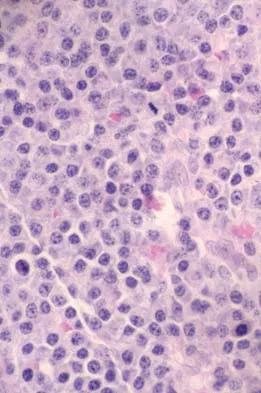 Orthopedic Surgery Board Review 2026 | High-Yield MCQs - Set 5 - Figure 39