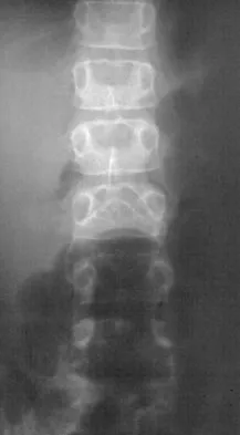 Orthopedic Surgery Board Review 2026 | High-Yield MCQs - Set 5 - Figure 40