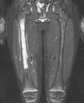 Orthopedic Surgery Board Review 2026 | High-Yield MCQs - Set 5 - Figure 53