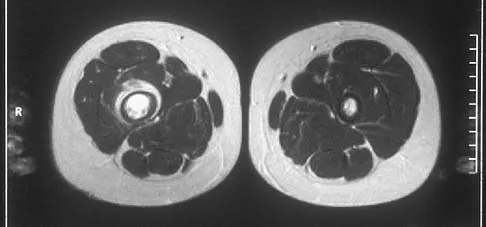 Orthopedic Surgery Board Review 2026 | High-Yield MCQs - Set 5 - Figure 54