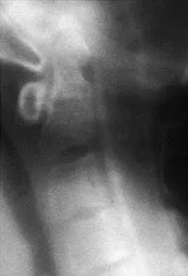 Orthopedic Surgery Board Review 2026 | High-Yield MCQs - Set 5 - Figure 81