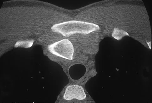 Orthopedic Surgery Board Review 2026 | High-Yield MCQs - Set 5 - Figure 82