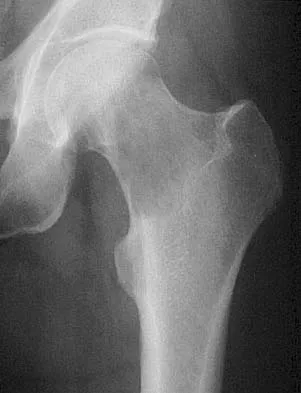 Orthopedic Surgery Board Review 2026 | High-Yield MCQs - Set 5 - Figure 86