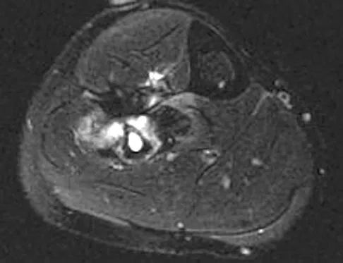 Orthopedic Surgery Board Review 2026 | High-Yield MCQs - Set 5 - Figure 92