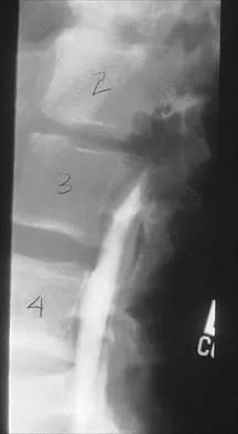 Orthopedic Surgery Board Review 2026 | High-Yield MCQs - Set 5 - Figure 97