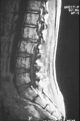 Orthopedic Surgery Board Review 2026 | High-Yield MCQs - Set 5 - Figure 99