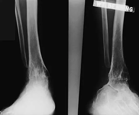 Orthopedic Surgery Board Review 2026 | High-Yield MCQs - Set 6 - Figure 10