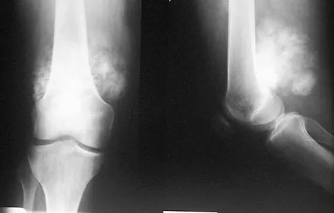Orthopedic Surgery Board Review 2026 | High-Yield MCQs - Set 6 - Figure 101