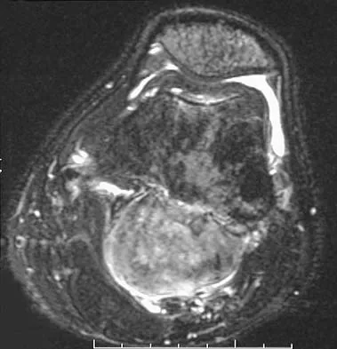 Orthopedic Surgery Board Review 2026 | High-Yield MCQs - Set 6 - Figure 103