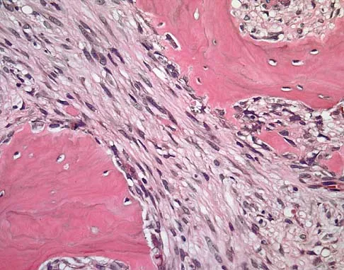 Orthopedic Surgery Board Review 2026 | High-Yield MCQs - Set 6 - Figure 105