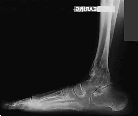 Orthopedic Surgery Board Review 2026 | High-Yield MCQs - Set 6 - Figure 11