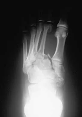 Orthopedic Surgery Board Review 2026 | High-Yield MCQs - Set 6 - Figure 112