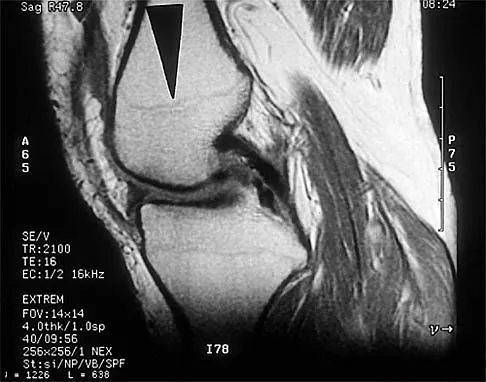 Orthopedic Surgery Board Review 2026 | High-Yield MCQs - Set 6 - Figure 116
