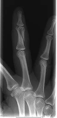 Orthopedic Surgery Board Review 2026 | High-Yield MCQs - Set 6 - Figure 29