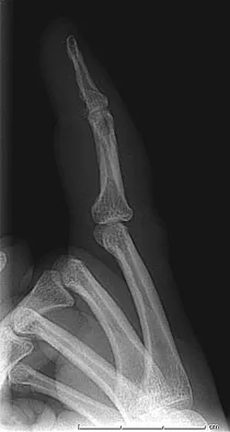 Orthopedic Surgery Board Review 2026 | High-Yield MCQs - Set 6 - Figure 30