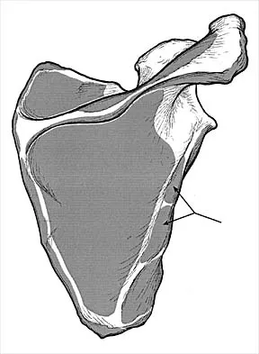Orthopedic Surgery Board Review 2026 | High-Yield MCQs - Set 6 - Figure 35
