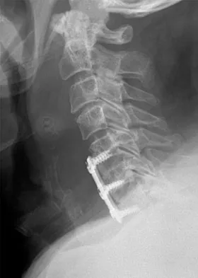 Orthopedic Surgery Board Review 2026 | High-Yield MCQs - Set 6 - Figure 37