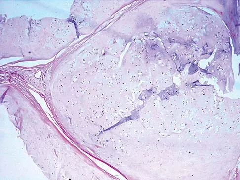 Orthopedic Surgery Board Review 2026 | High-Yield MCQs - Set 6 - Figure 55