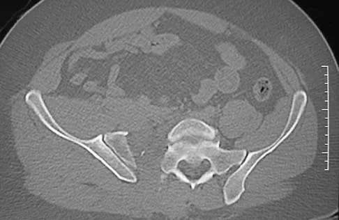 Orthopedic Surgery Board Review 2026 | High-Yield MCQs - Set 6 - Figure 61