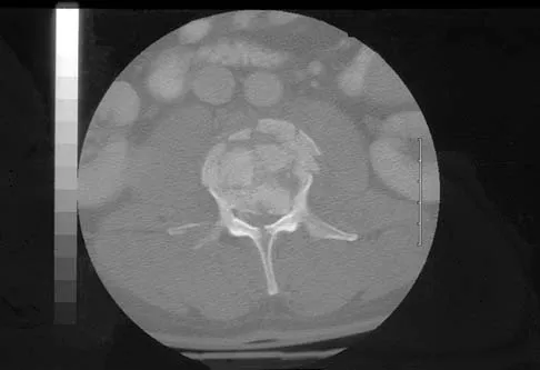 Orthopedic Surgery Board Review 2026 | High-Yield MCQs - Set 6 - Figure 62