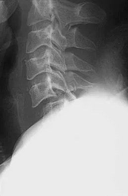 Orthopedic Surgery Board Review 2026 | High-Yield MCQs - Set 6 - Figure 64