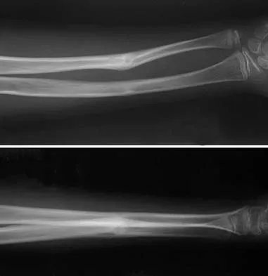 Orthopedic Surgery Board Review 2026 | High-Yield MCQs - Set 6 - Figure 65