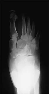 Orthopedic Surgery Board Review 2026 | High-Yield MCQs - Set 6 - Figure 78