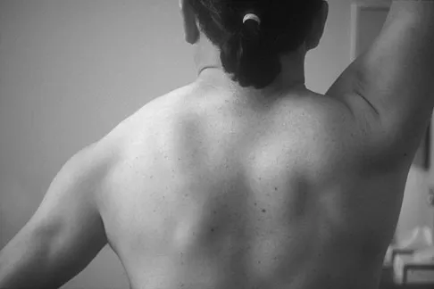 Orthopedic Surgery Board Review 2026 | High-Yield MCQs - Set 6 - Figure 83