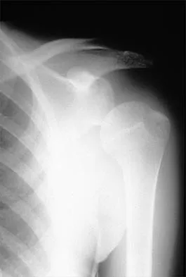 Orthopedic Surgery Board Review 2026 | High-Yield MCQs - Set 7 - Figure 104