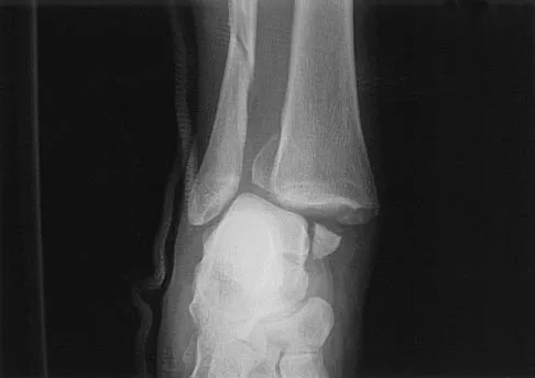 Orthopedic Surgery Board Review 2026 | High-Yield MCQs - Set 7 - Figure 105