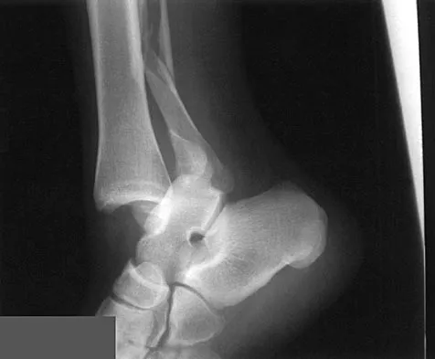 Orthopedic Surgery Board Review 2026 | High-Yield MCQs - Set 7 - Figure 106