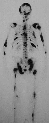 Orthopedic Surgery Board Review 2026 | High-Yield MCQs - Set 7 - Figure 11
