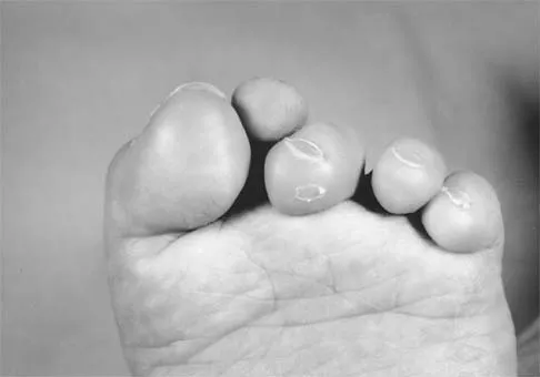 Orthopedic Surgery Board Review 2026 | High-Yield MCQs - Set 7 - Figure 15