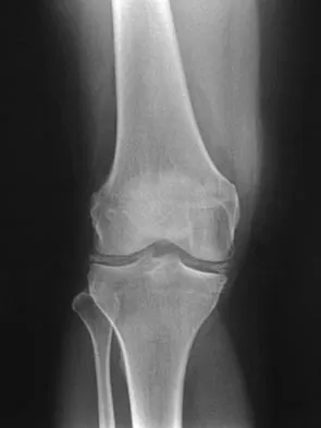 Orthopedic Surgery Board Review 2026 | High-Yield MCQs - Set 7 - Figure 25