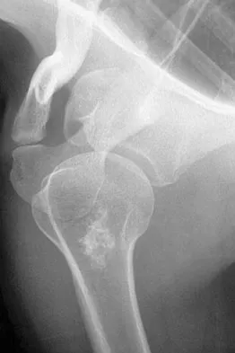 Orthopedic Surgery Board Review 2026 | High-Yield MCQs - Set 7 - Figure 50