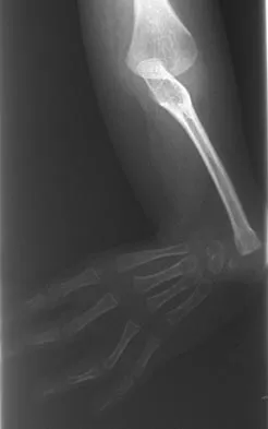 Orthopedic Surgery Board Review 2026 | High-Yield MCQs - Set 7 - Figure 61